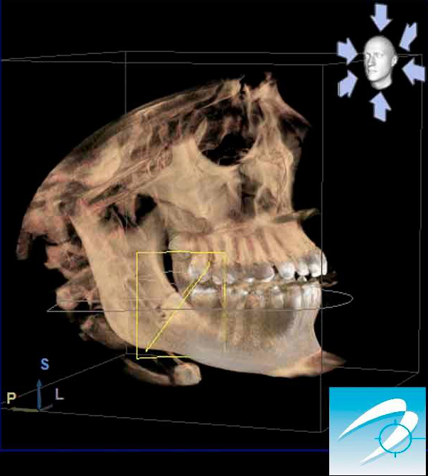 TAC CONE BEAM 3D